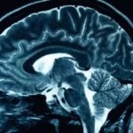 How This Study Could Help Doctors Diagnose Brain Tumors Faster—and Better