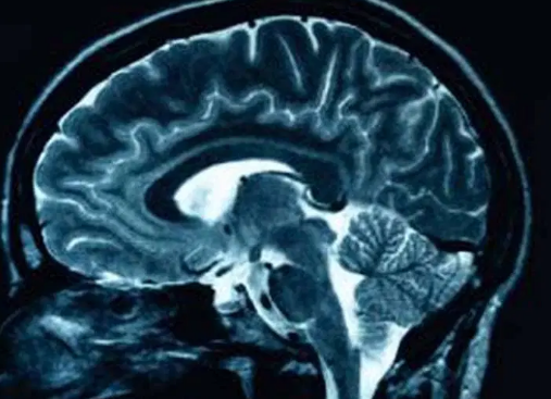 How This Study Could Help Doctors Diagnose Brain Tumors Faster—and Better