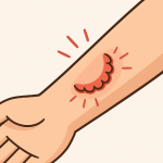 The Hidden Rise of Human Bite Injuries in Ghana