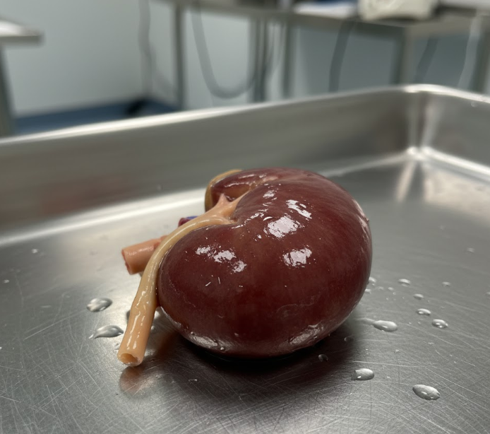 Organ Trafficking: The Global Crisis Hiding in Plain Sight